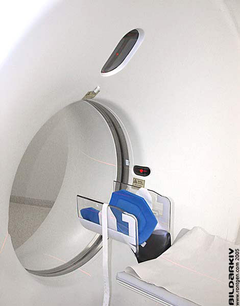 Skillnad Mellan Datortomografi Och Skiktröntgen